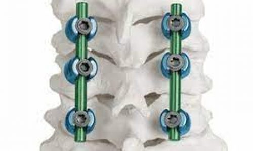 cervical posterior3 cervical posterior3